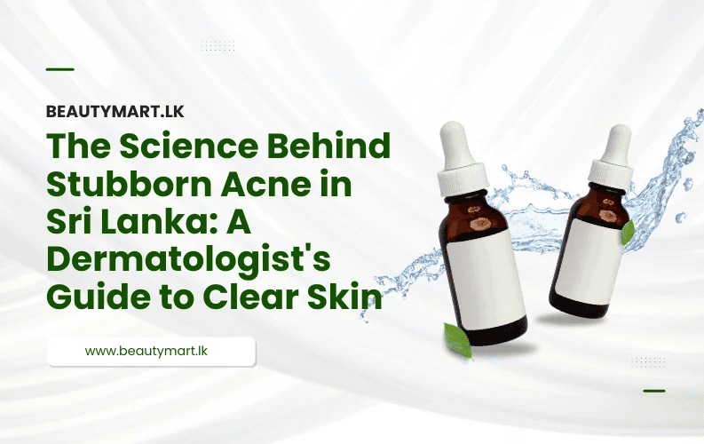 The Science Behind Stubborn Acne in Sri Lanka: A Dermatologist's Guide to Clear Skin