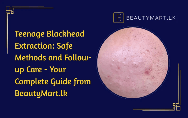 Teenage Blackhead Extraction Safe Methods and Follow-up Care - Your Complete Guide from BeautyMart.lk