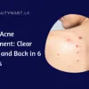 Body Acne Treatment Clear Chest and Back in 6 Weeks